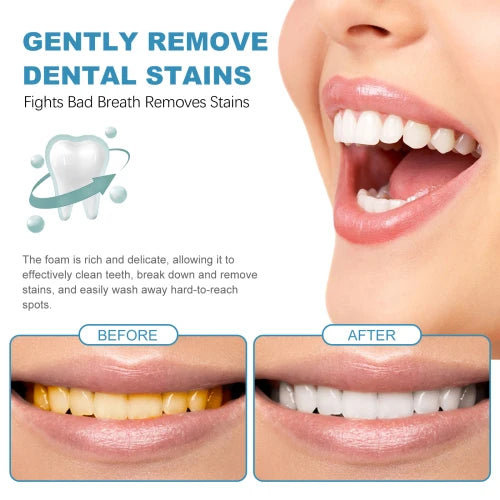 Oralhoe Beauty Tooth Fresh Pure Mousse  Clean Bad Breath Stains White Teeth Gums Care Toothpaste