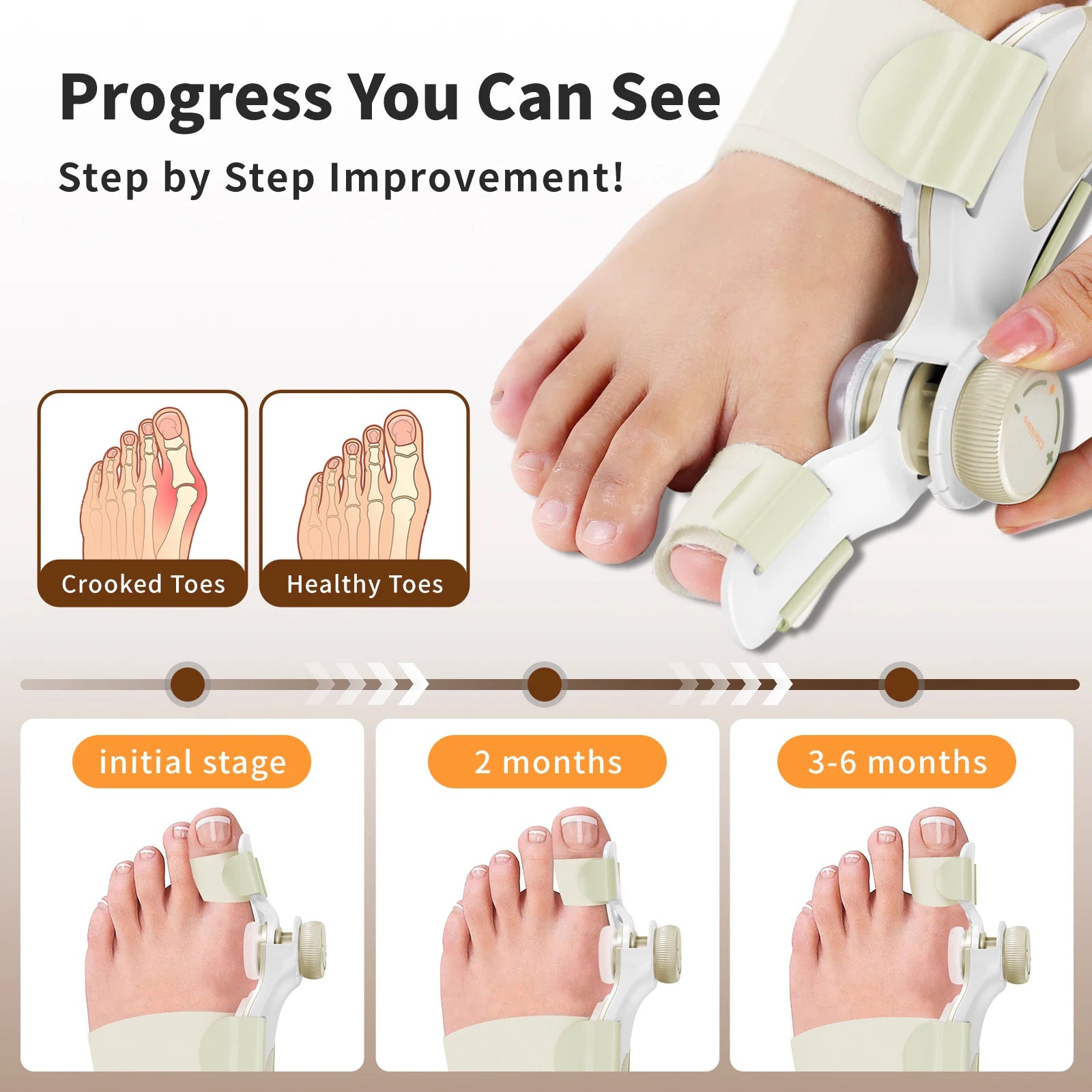 Adjustable Women's Yellow Bunion Corrector Big Toe Fix Device with Knob and 3 Angled Plates Medium Strap 1 PCS Toe Separator