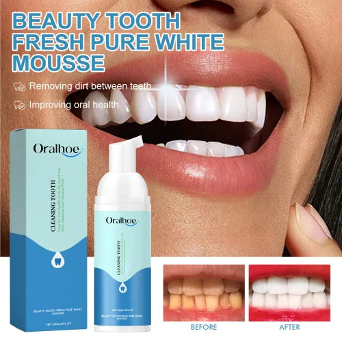 Oralhoe Beauty Tooth Fresh Pure Mousse  Clean Bad Breath Stains White Teeth Gums Care Toothpaste